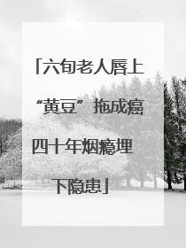 六旬老人唇上“黄豆”拖成癌 四十年烟瘾埋下隐患